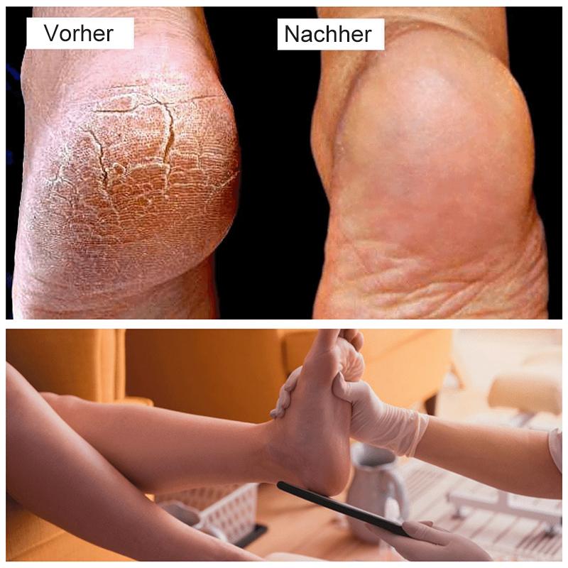 Pediküre Fußfeile